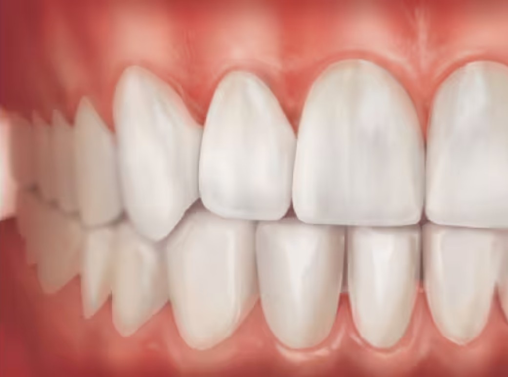 Seeking Gum Health Solutions