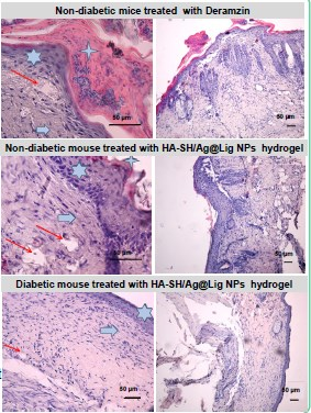 Nanoenabled hydrogels for advanced skin care : SkinGel