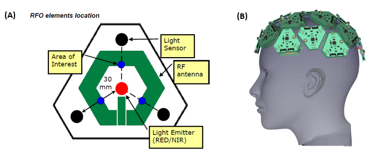 Multimodel Transcranial Optical Vascular Assessment